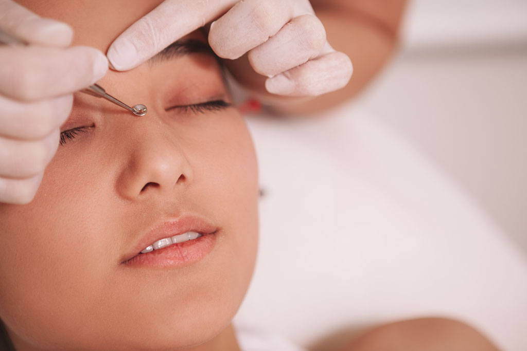 Our Top 4 Facial Treatments For Blackhead Removal