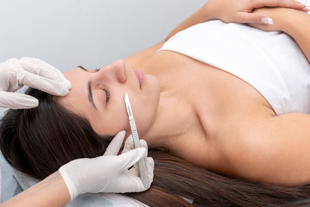 Ultimate Dermaplaning Guide Before Your Wedding Day