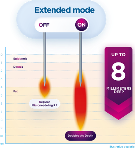 Emface microneedling images